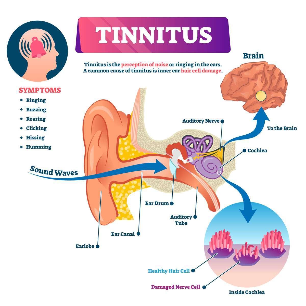 Consejos prácticos para manejar⁣ y prevenir el tinnitus