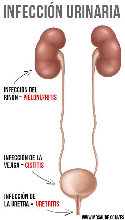 Consejos Prácticos para​ Aliviar ⁤el​ Malestar al Hacer⁣ Pipí