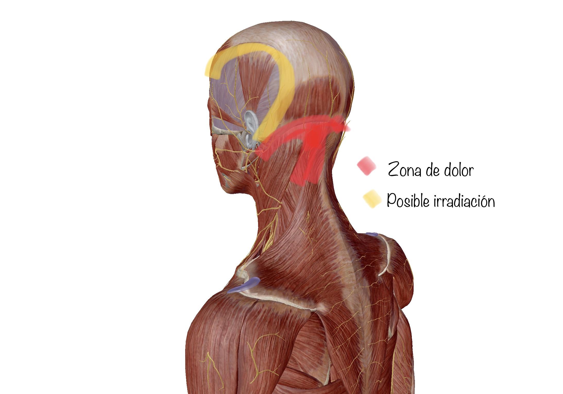 Ejercicios⁣ y Técnicas ⁤para Aliviar el Dolor ‌Cervical y​ Cefálico