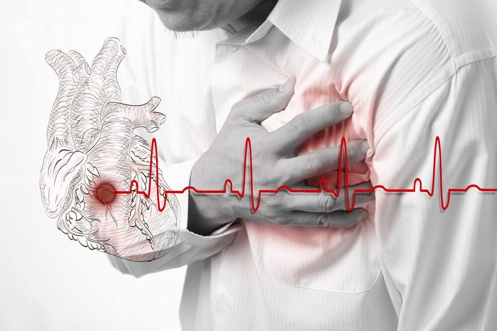 Mitos y Realidades‍ sobre el Dolor en el Pecho