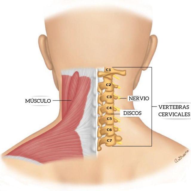 Causas Comunes​ del Dolor de Cuello y Cabeza en la Vida Diaria