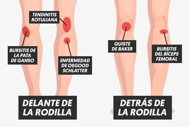 Ejercicios⁢ y Tratamientos Recomendados para⁣ Aliviar ‍el Dolor en la ​Rodilla Izquierda