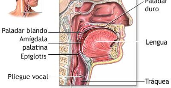 porque me duele la garganta