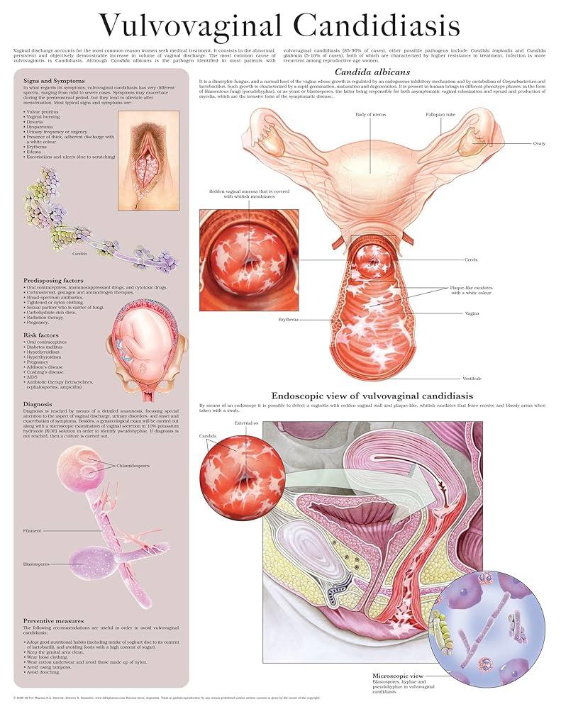 Causas comunes de ⁢la candidiasis post relaciones sexuales