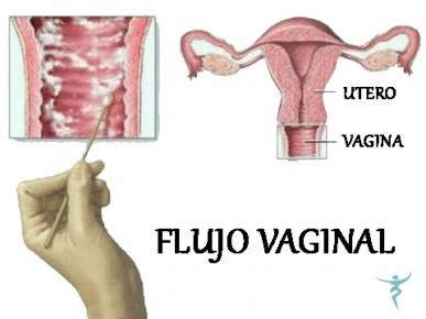 Factores que Influyen ⁤en la Cantidad de Flujo⁣ Vaginal