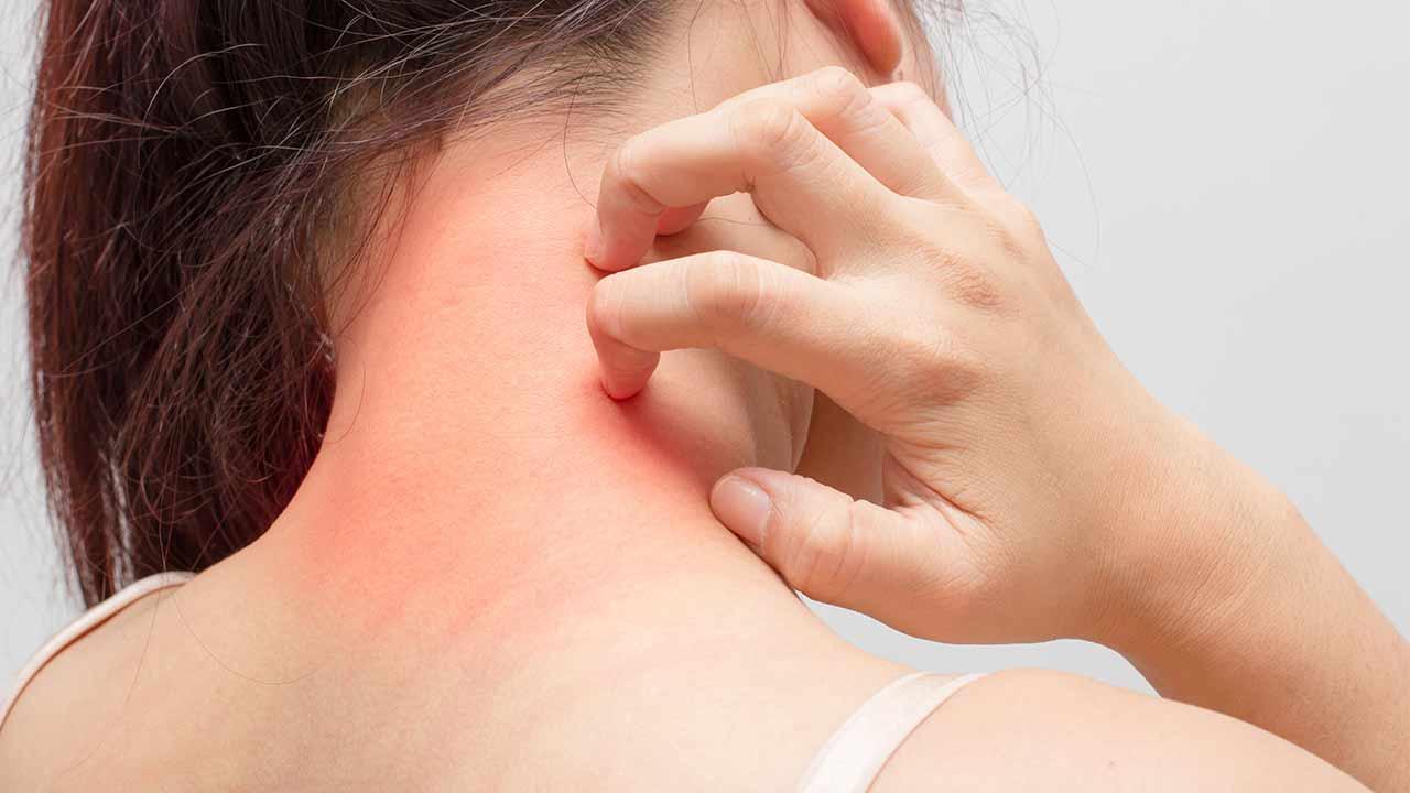 Productos que podrían agravar la irritación y cómo elegir los adecuados